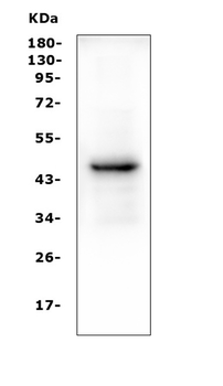 Anti-PAX5 Antibody (monoclonal, 6I4)