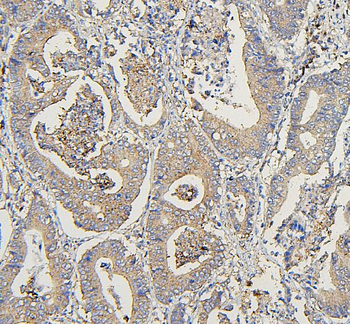 Anti-COPE Antibody (monoclonal, 9B6)