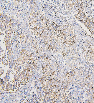 Anti-COPE Antibody (monoclonal, 9B6)
