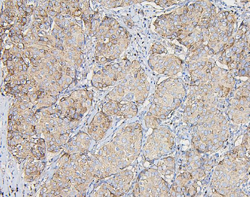 Anti-COPE Antibody (monoclonal, 9B6)