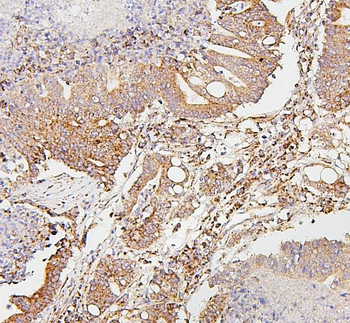SDHB Antibody (monoclonal, 11I3)