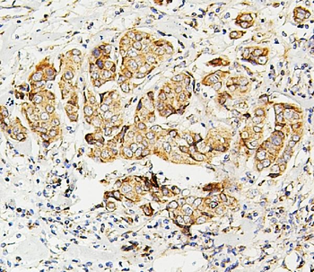 Anti-SDHB Antibody (monoclonal, 11I3)