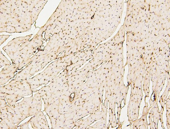 Anti-SDHB Antibody (monoclonal, 11I3)