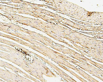 Anti-SDHB Antibody (monoclonal, 11I3)