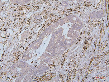 Anti-Desmin Antibody (monoclonal, 2B5)