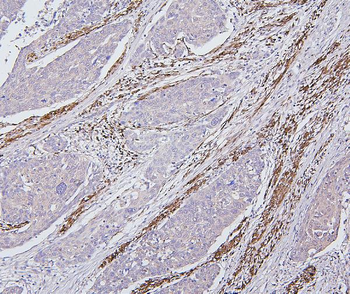 Anti-Desmin Antibody (monoclonal, 2B5)
