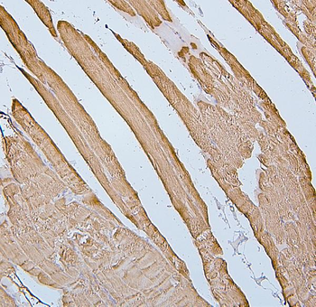 Anti-Desmin Antibody (monoclonal, 2B5)
