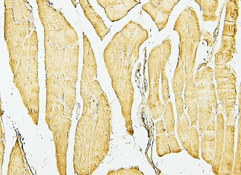 Anti-Desmin Antibody (monoclonal, 2B5)