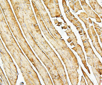Anti-Desmin Antibody (monoclonal, 2B5)