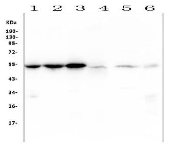 Anti-Desmin Antibody (monoclonal, 2B5)
