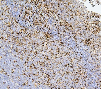 CD43/SPN Antibody (monoclonal, 4I3)