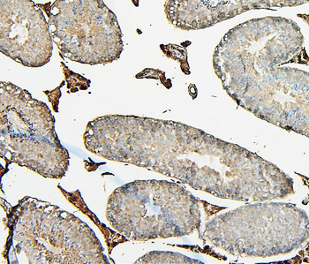Anti-COMT Antibody (monoclonal, 15C10)