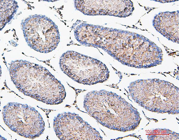 Anti-COMT Antibody (monoclonal, 15C10)