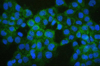 Anti-COMT Antibody (monoclonal, 15C10)