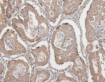 Anti-COMT Antibody (monoclonal, 15C10)