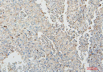 Anti-COMT Antibody (monoclonal, 15C10)
