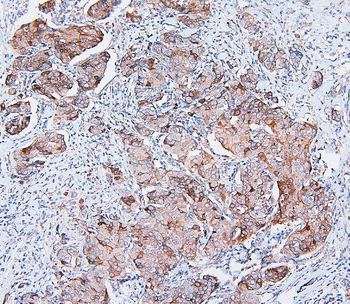 Anti-COMT Antibody (monoclonal, 15C10)