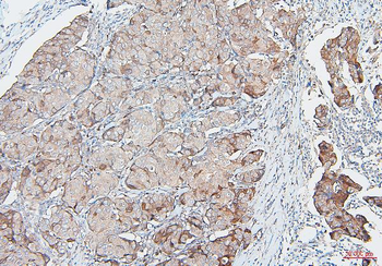 Anti-COMT Antibody (monoclonal, 15C10)