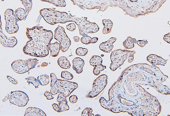 Anti-COMT Antibody (monoclonal, 15C10)