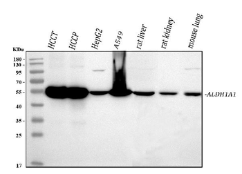Anti-Retinal dehydrogenase 1 ALDH1A1 Antibody