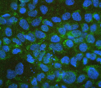 Anti-Retinal dehydrogenase 1 ALDH1A1 Antibody