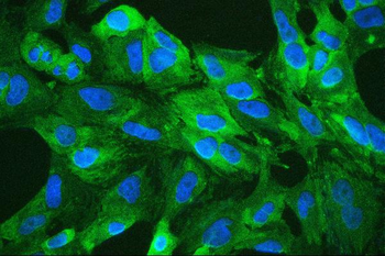 Anti-Retinal dehydrogenase 1 ALDH1A1 Antibody