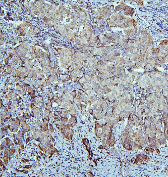 Anti-Retinal dehydrogenase 1 ALDH1A1 Antibody