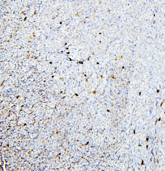 Anti-Retinal dehydrogenase 1 ALDH1A1 Antibody