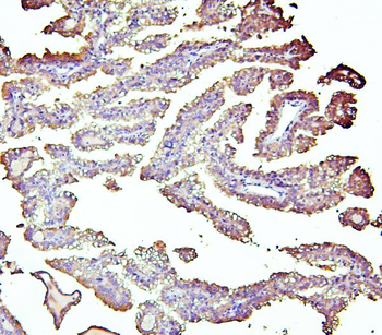 Anti-Retinal dehydrogenase 1 ALDH1A1 Antibody