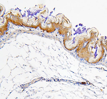 Anti-Retinal dehydrogenase 1 ALDH1A1 Antibody