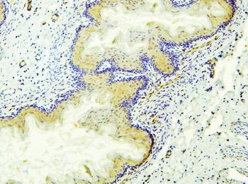Anti-Retinal dehydrogenase 1 ALDH1A1 Antibody