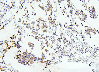 DCC Antibody