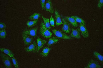 Anti-EIF4A1/2/3 Antibody