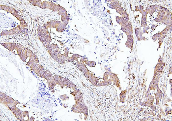 Anti-EIF4A1/2/3 Antibody