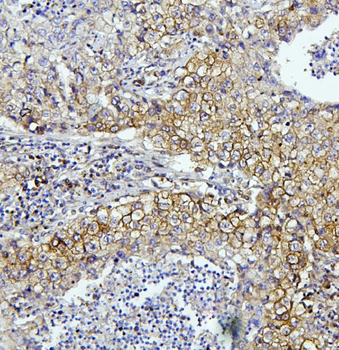 Anti-EIF4A1/2/3 Antibody