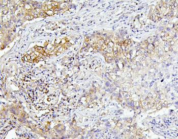Anti-EIF4A1/2/3 Antibody