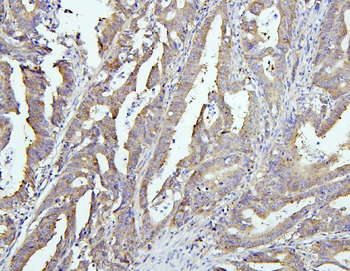 Anti-EIF4G1 Antibody