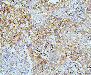 Anti-EIF4G1 Antibody