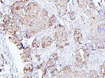 Anti-EIF4G1 Antibody