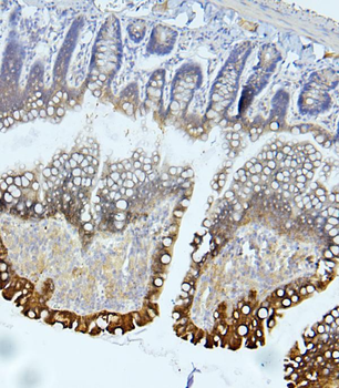 Anti-EIF4G1 Antibody
