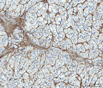 Anti-Fibronectin/FN1 Antibody