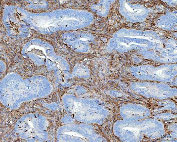 Anti-Fibronectin/FN1 Antibody