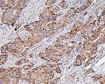 Anti-Hexokinase 1/HK1 Antibody