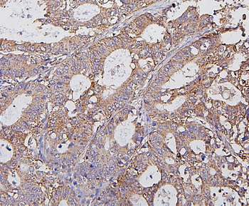 Anti-Hexokinase 1/HK1 Antibody