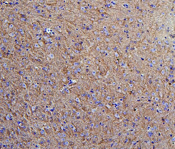 Anti-Hexokinase 1/HK1 Antibody