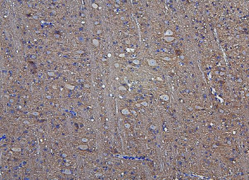 Anti-Hexokinase 1/HK1 Antibody