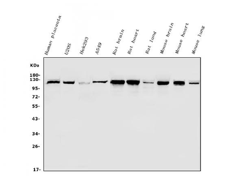 Anti-Hexokinase 1/HK1 Antibody
