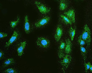 Anti-MMP1 Antibody