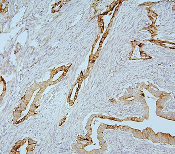Anti-MMP1 Antibody