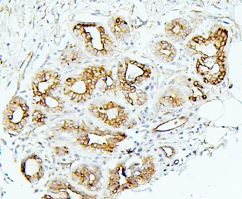 Anti-MMP1 Antibody